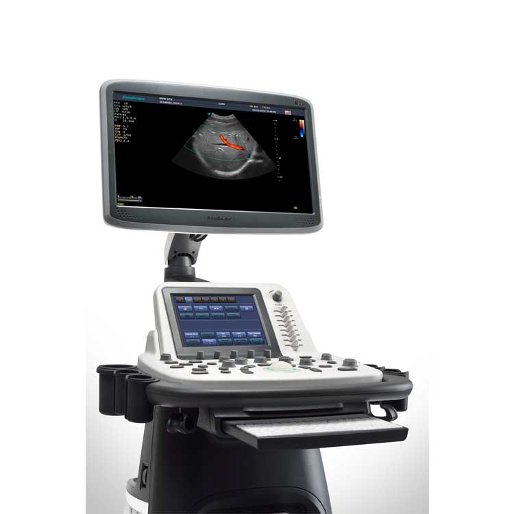 High technology 3d/4d Medical Ultrasound Instruments Other Ultrasonic Trolley Color Ultrasound with elastography Sonoscape S22
