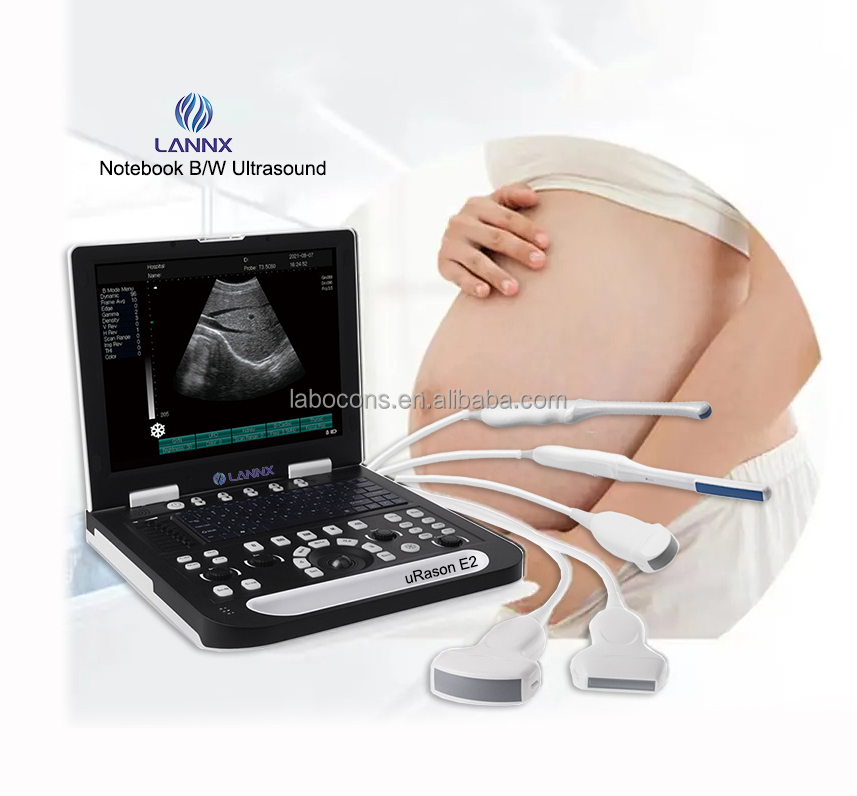 LANNX uRason E2 Portable Ultrasound Machine Full Digital Ultrasonic Diagnostic Imaging System 3D image portable B/W ultrasound