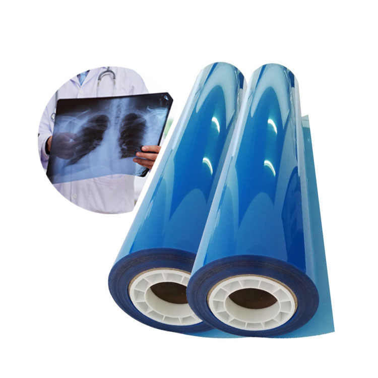 8x10 A3 A4 PET Radiology 210um синяя струйная цифровая медицинская рентгеновская пленка