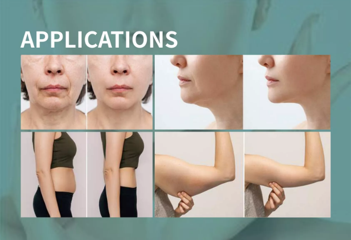 2022 Newest Portable 8 in 1 40K Vacuum Cavitation RF Lipolaser Cellulite Reduction Body Slimming Cavitation Machine