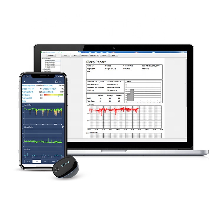 Монитор апноэ во сне Wellue O2Ring, портативный цифровой Пальчиковый оксиметр, Bluetooth