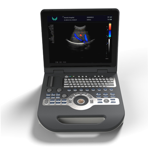 Hospital Laptop Ultrasound Medical Equipment for Sale Ultrasonic Diagnostic Instrument