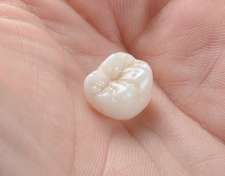 Зубные короны из циркония, зубы из циркония, цена, полностью керамический Цирконий