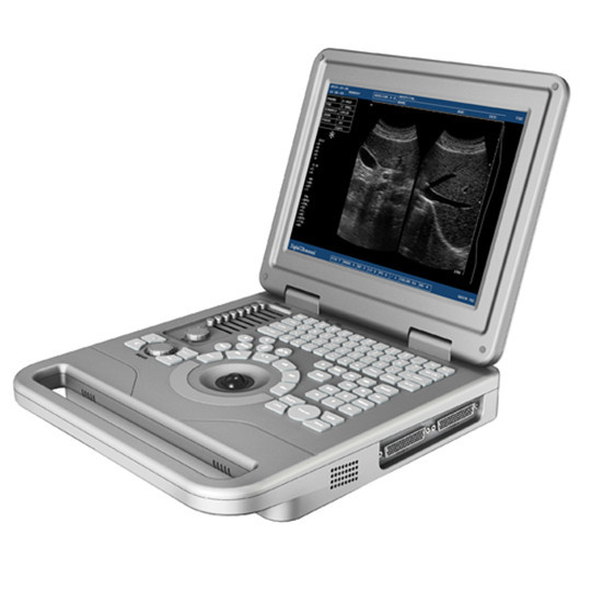 Full Digital Ultrasonic Diagnostic System B/W Portable Ultrasound Scanner System Ultrasound Machine