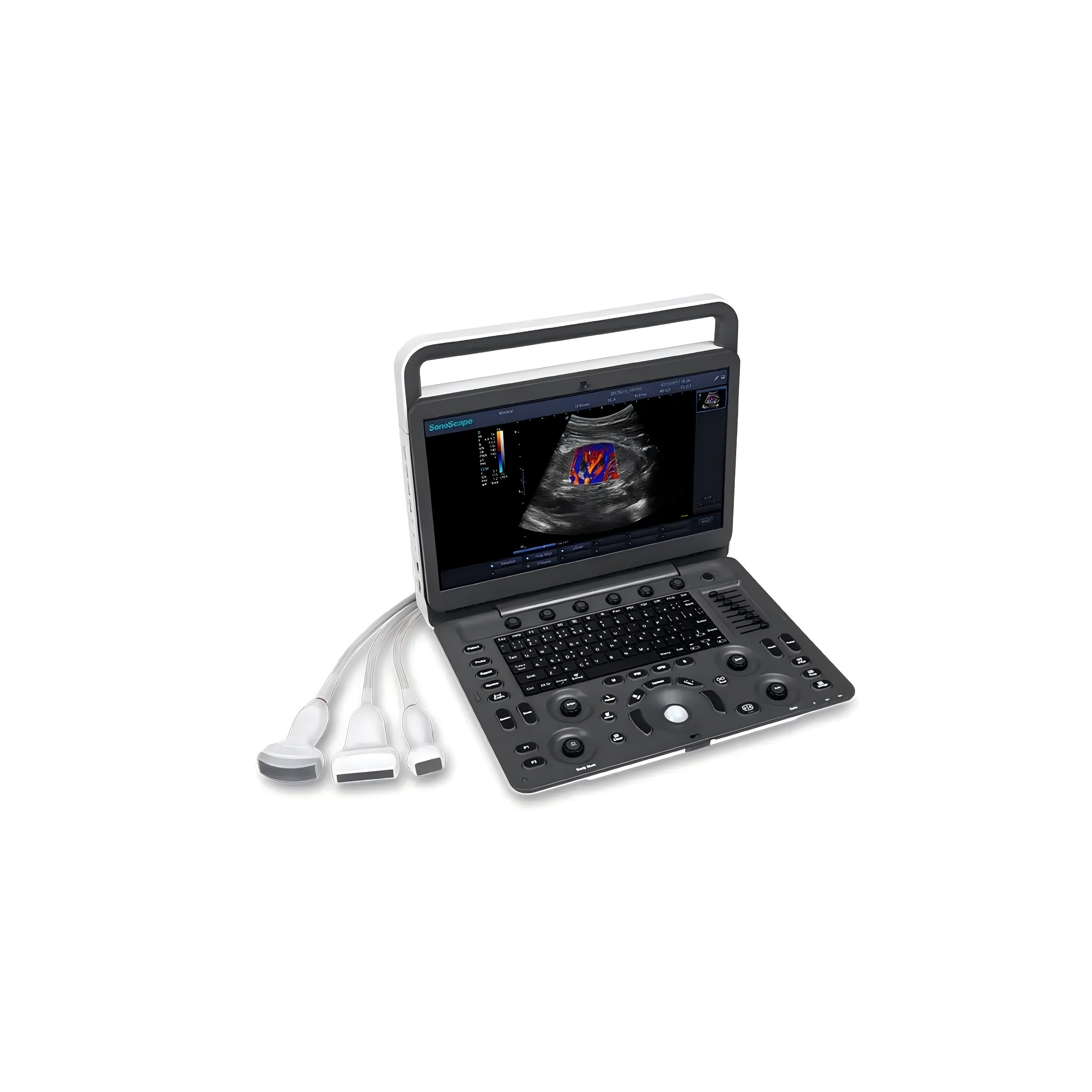 Sonoscape E1expv Best Price High Quality Portable Color Doppler Ultrasound Ecografo Color Doppler Ultrasound Machine for Vet
