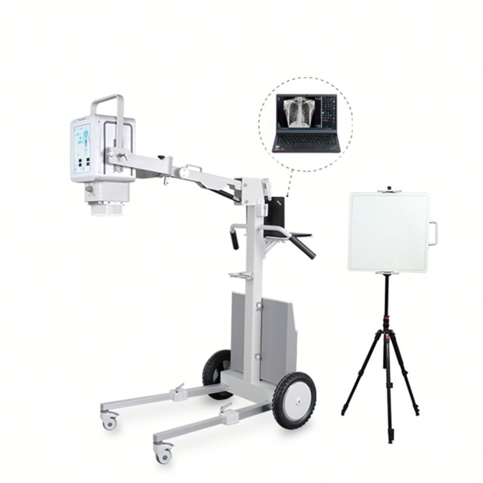 New Style Hot Selling Portable X-Ray Inspection Equipment Digital Medical Diagnosis X-Ray Imaging Device