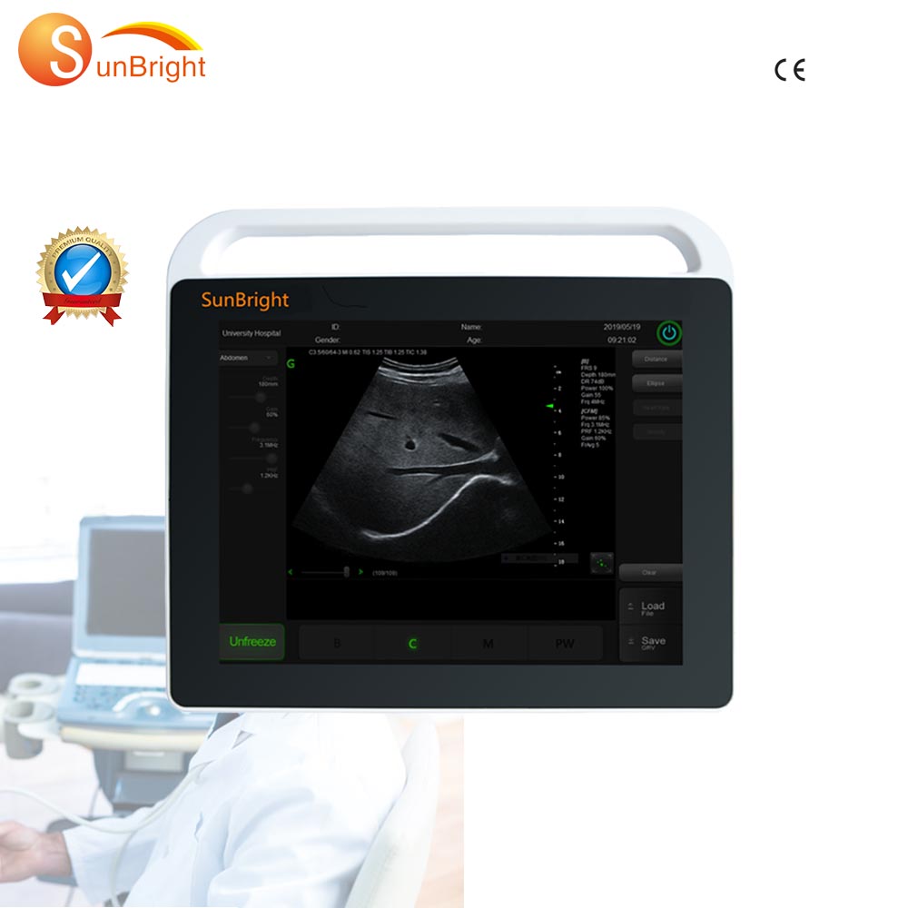 SUN-800S многофункциональная медицинская цифровой портативный ультразвуковой сканирующая машина