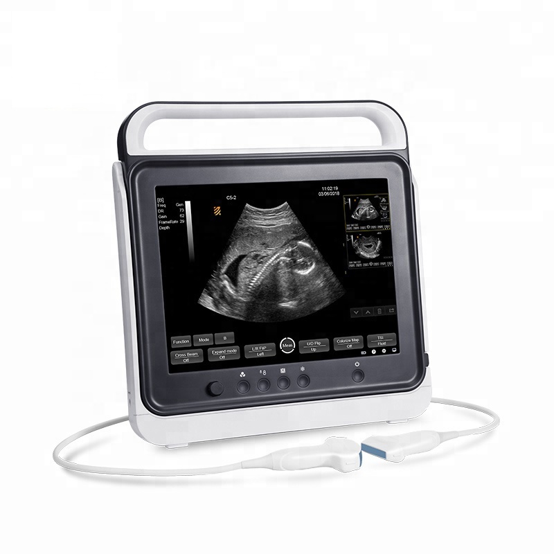 laptop portable animals ultrasound/ Veterinary Ultrasound Machine/Vet Handheld Ultrasound Scanner