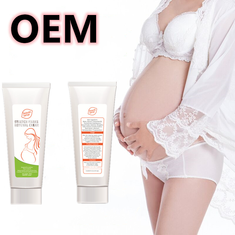 OEM NO MOQ Wholesale price organic skin care cream stretch mark removal