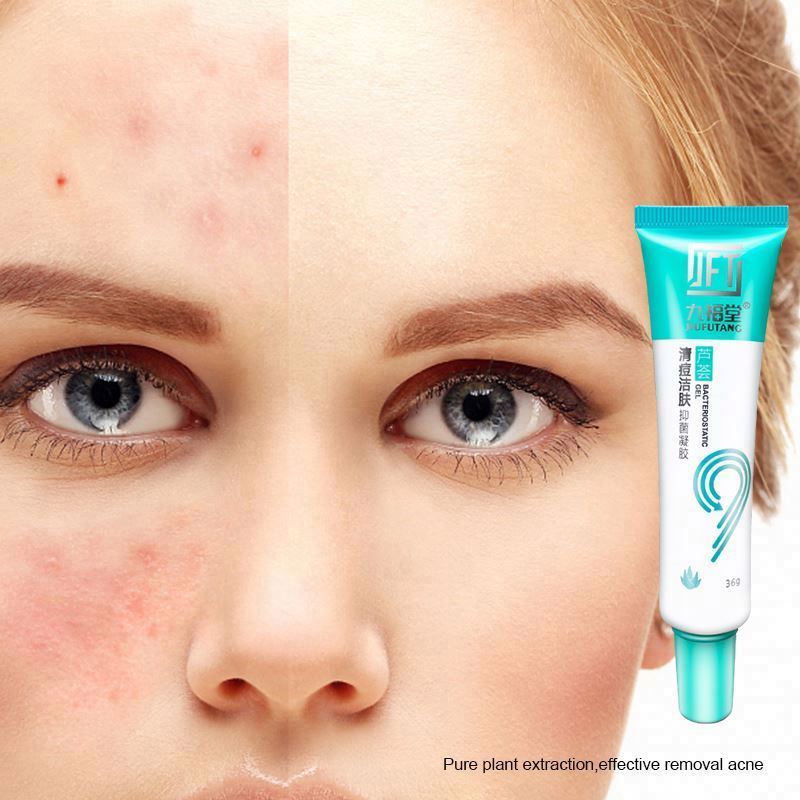 L aloe vera on face everyday results before and after overnight