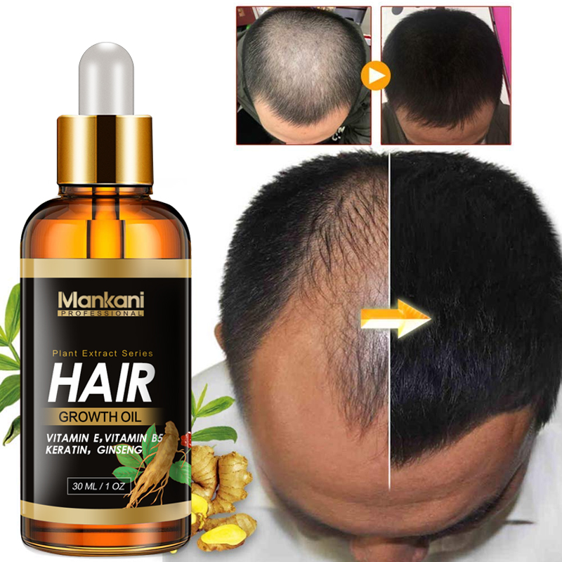 organic wild natural private label minoxidi 5 vitamins serum oil spray hair growth treatment