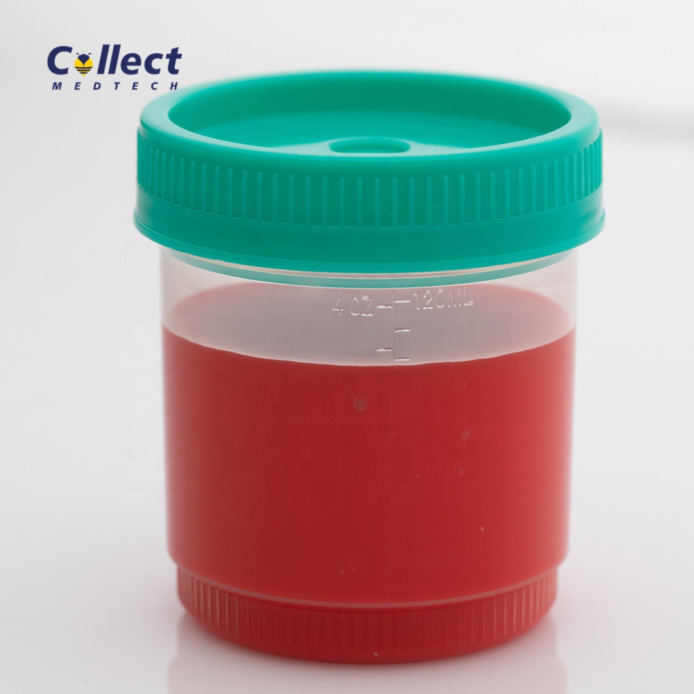 120ml histology container for formalin