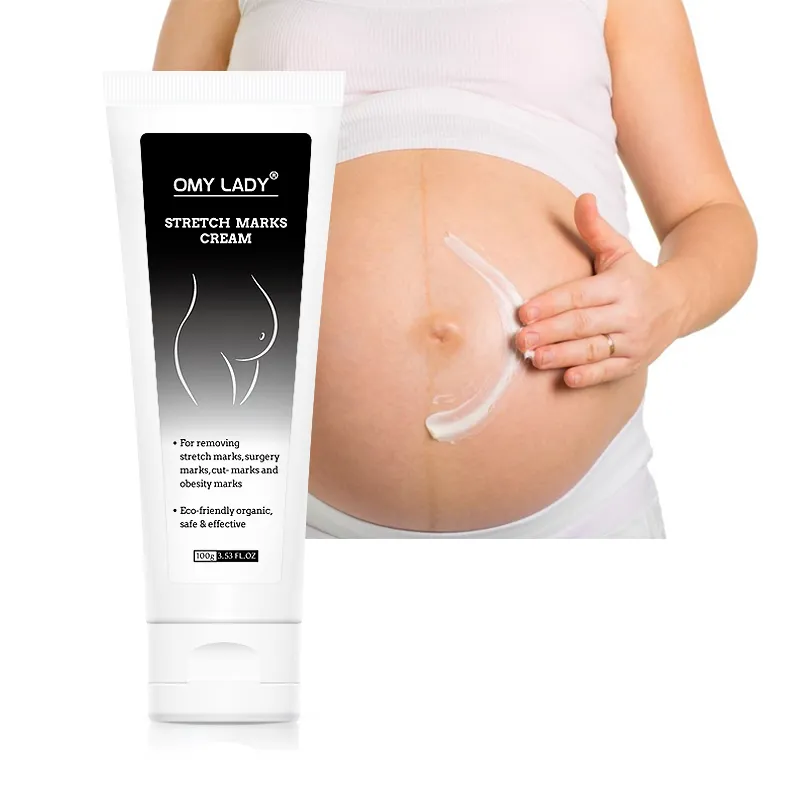 Wholesale Amazon Anti Aging Alovera Gel Scar Gel Maternity Skin Repair Treatment Advanced Stretch Mark Removal Cream