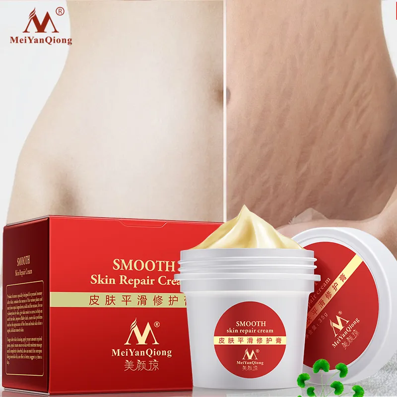 Amazon Hot Sale stretch marks scar removal cream Maternity treatment Anti Vergeture Repair Stretch Mark Cream