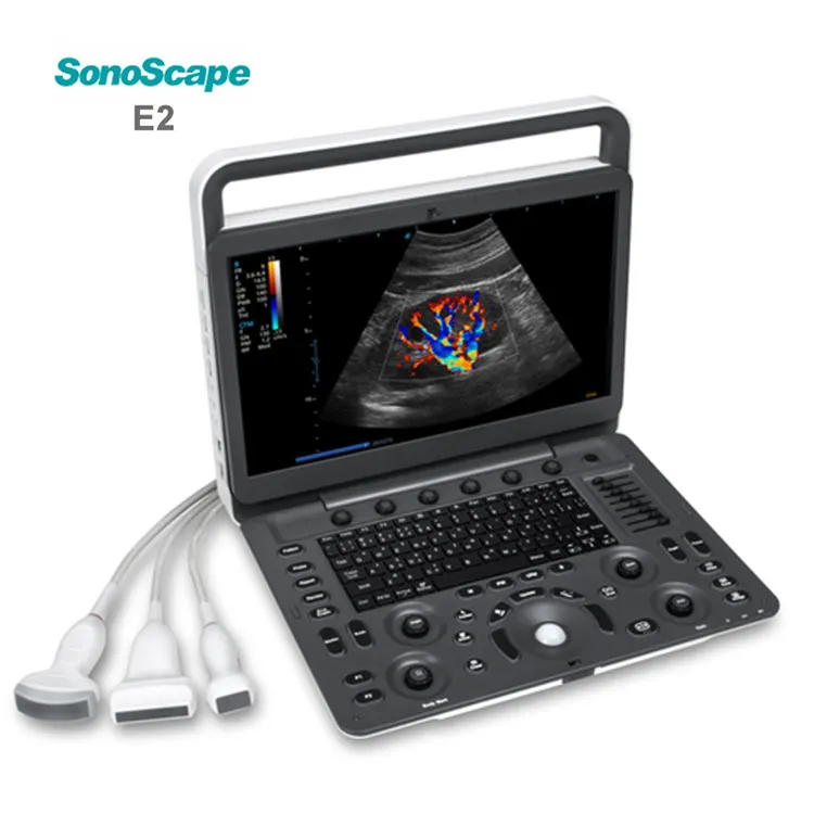 2023 Medsinglong Medical Ultrasound Instrument MSK OB/GYN 3D 4D 5D Ultrasound Scanner Sonoscape E2 Portable Ultrasound Machine