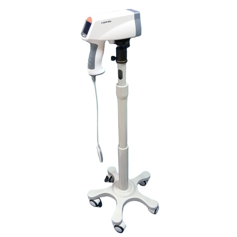 Mini type portable gynaecology equipment digital colposcope machine