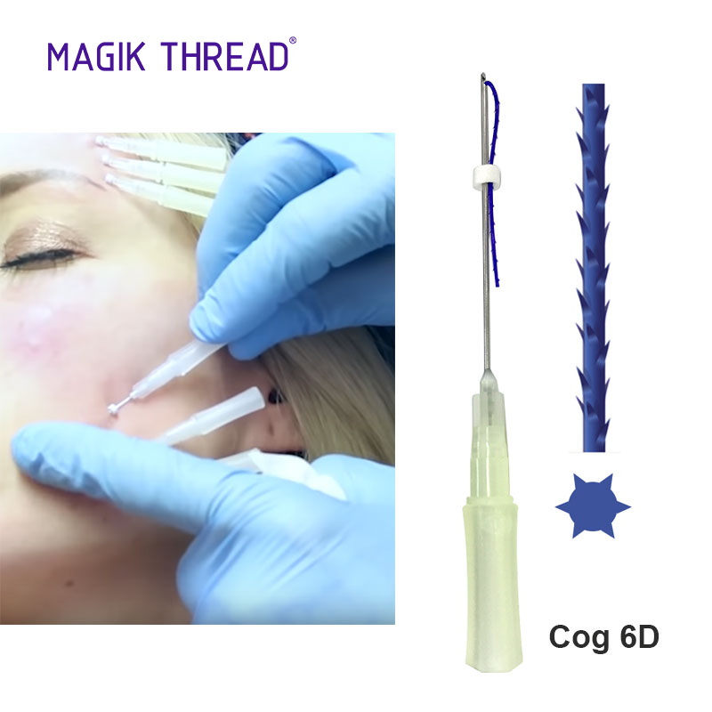 Продвинутый Cog 6D W Blunt 18G 100 мм, hilos ten125, резьба для лифтинга лица, Секретная линия, pdo провод