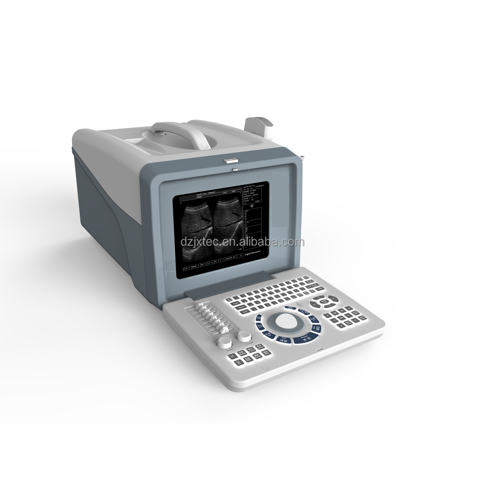 Factory S218 High Quality black and white Digital Ultrasonic Diagnostic Imaging System B/W Portable Ultrasound