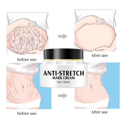 Natural Organic Stretch Mark Remove Cream Skin Repair Anti Vergeture For Pregnancy Repair Scar Marks Stretch Mark Cream Removal