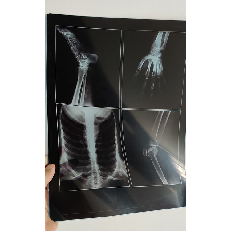 10x12 дюймов медицинская xray пленка, сухая пленка для принтера AGFA Drystar 5302 и FUJI DRYPIX 2000