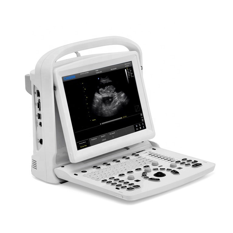 Ветеринарное ультразвуковое устройство chison vet chison eco 3, экспертная ультразвуковая машина для домашних животных