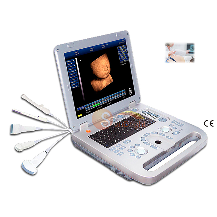 high quality hospital 2D ultrasound diagnostic system laptop echo device