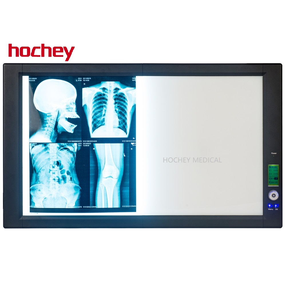 HOCHEY медицинский боковой излучающий светодиодный источник света коробка для просмотра двойная панель просмотра