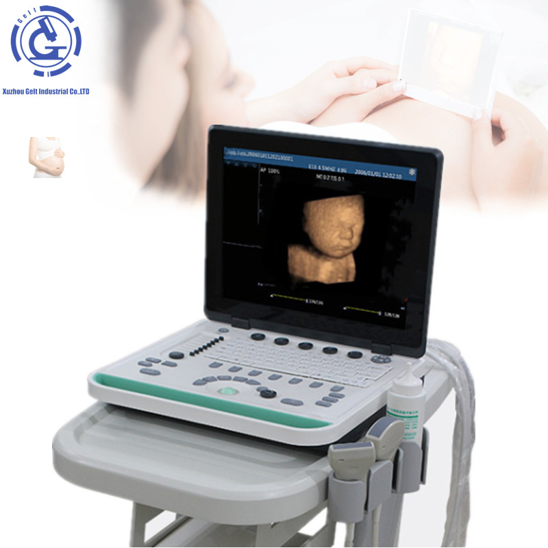Hot sale cheap ultrasonic optical electronic equipment 3D ultrasound