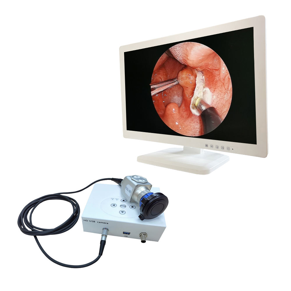 IN-HD7020 Factory Usb Full Hd 1080p Medical Video Endoscope Camera Ent Ear Endoscopy