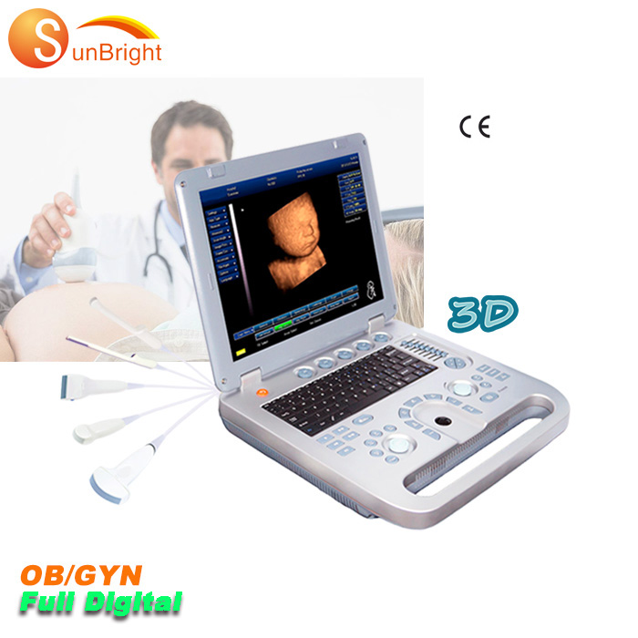 Ультразвуковая машина sonosite, Новое поступление, хорошее качество