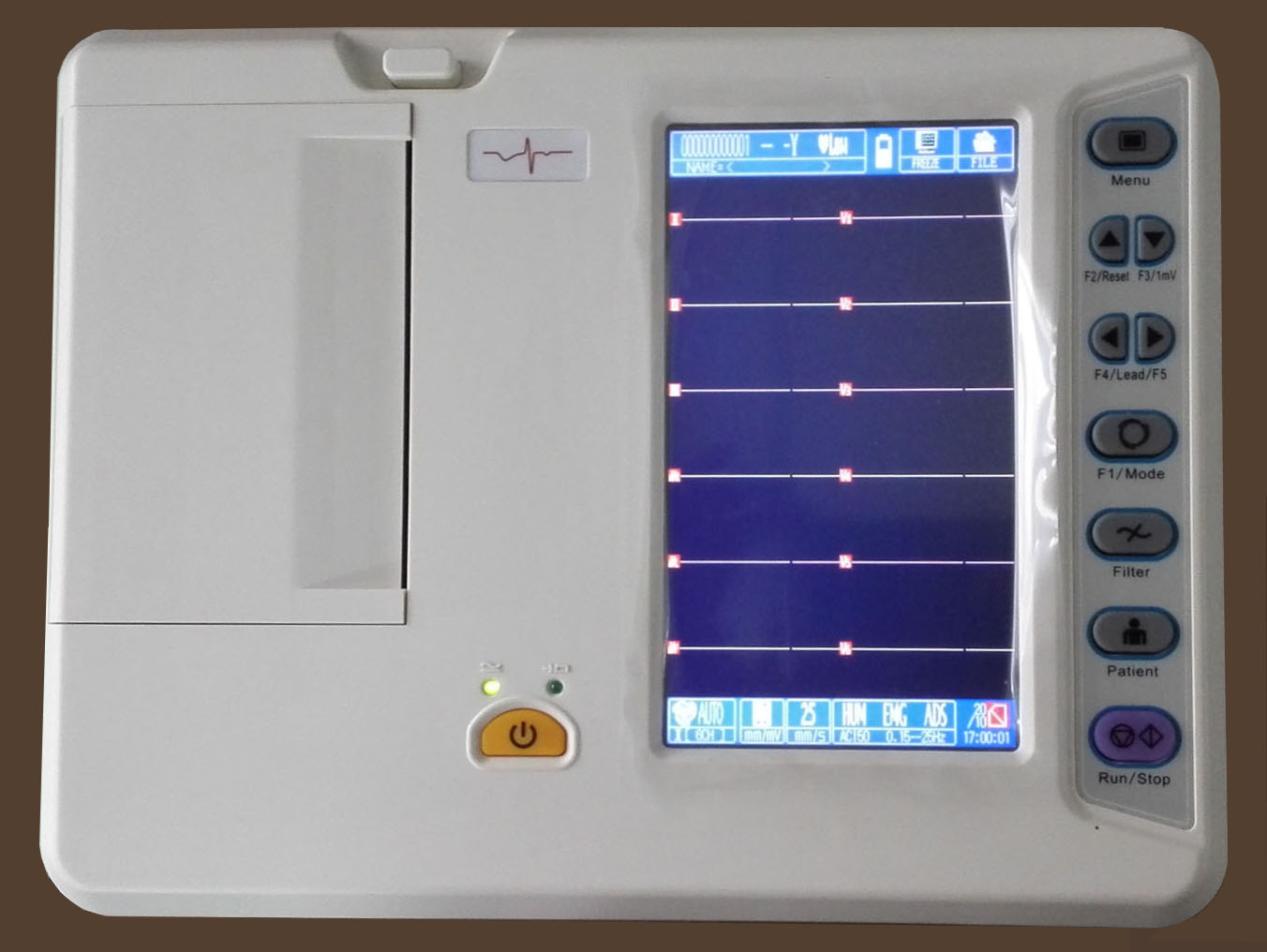 RC-ECG3306G 6-канальный цифровой ЭКГ-монитор