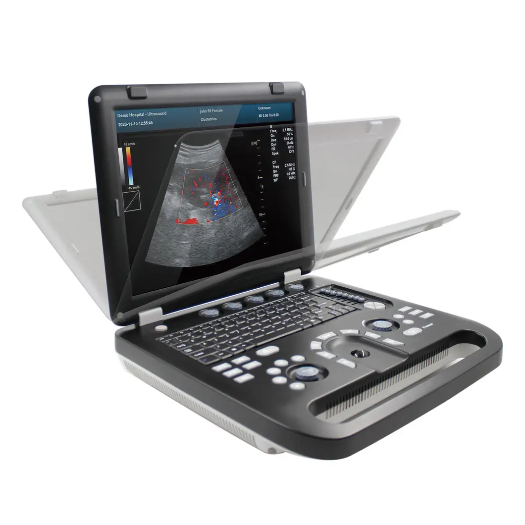 HUC-570 Medical Ultrasound Machine 4D 5D Color Dopplor Portable Cardiac Ultrasound System Price for Hospital