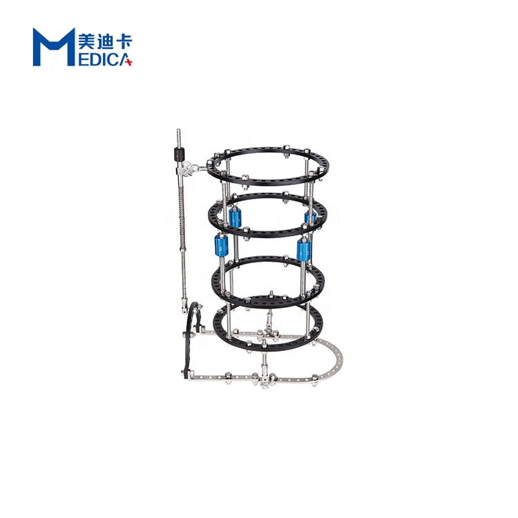 Equinus deformity treatment ring ilizarov type external fixtion for bone fracture treatment