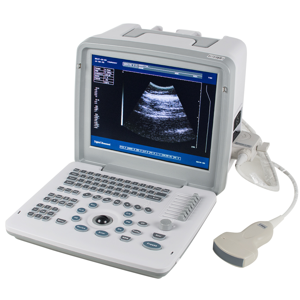 Good Price sonography machine ultrasonography Human use portable laptop ultrasound medical ultrasound instruments