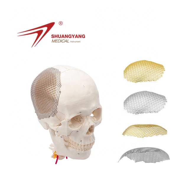 neurosurgery cranium skull defect repair and reconstruction mini mesh cranial screw and surgical titanium plates