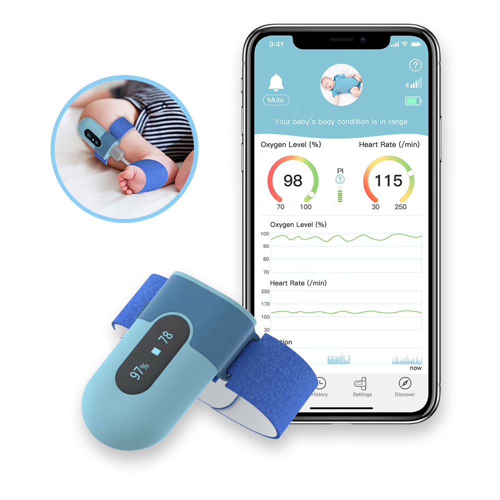 Умный детский Пульсоксиметр Wellue BabyO2, Bluetooth, Пульсоксиметр для новорожденных