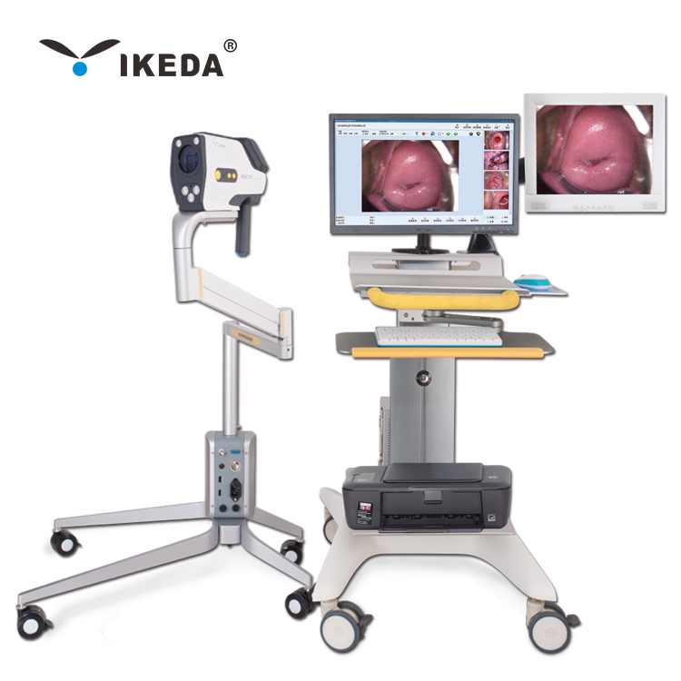YKD-3002 цифровой видео Colposcope с двойными экранами