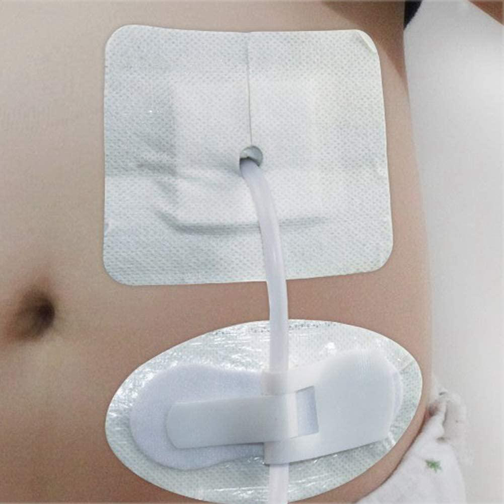 Urinary Catheter Leg Bag Holder Catheter Hook and Loop Fixing Device Sticker Catheter Supplies medical dressing