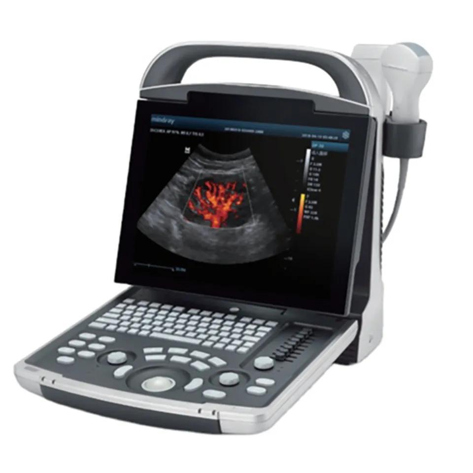 Medical portable ultrasound instruments high quality cost-effective machine factory priced and professional ultrasound device