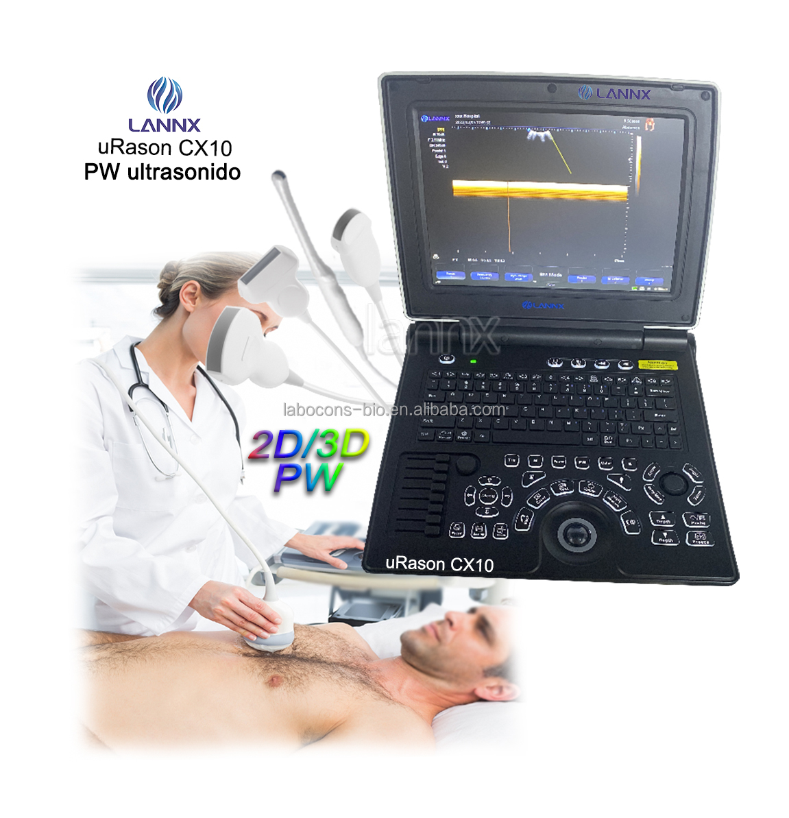 LANNX uRason CX10 LCD Screen USG Portable Ultrasonido Scanner Ultrasonido High Resolution Color Doppler Ultrasound Machine