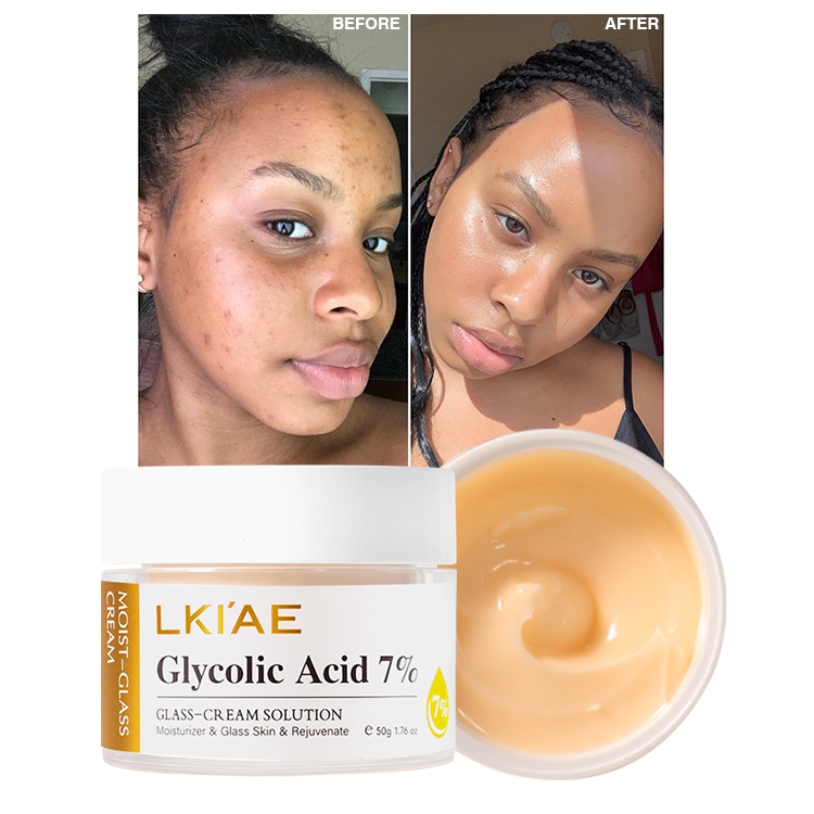 Manufacturer Glycolic Acid Peeling Melasma Cream Glutathio Vitamin C Lightening Antiage Facial Cream