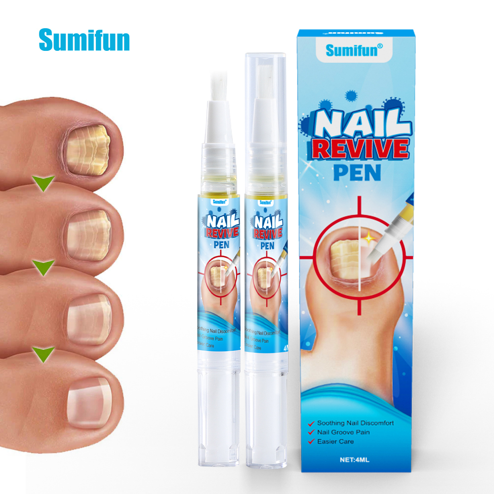 Sumifun Hot Selling Effective Painless Nails Anti Bacteria Nail Fungus Treatment Liquid