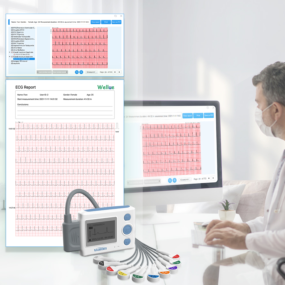 Viatom Th12 Ecg Medical 12 Channel 24 Hour Monitor System Holter Portable Ecg Device Monitoring Portable Machine Leads Ekg Ecg