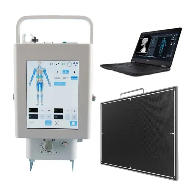 Popular Portable High Frequency 5.6kW 125Kv Handheld rx X-ray Machine For Humans and Animals