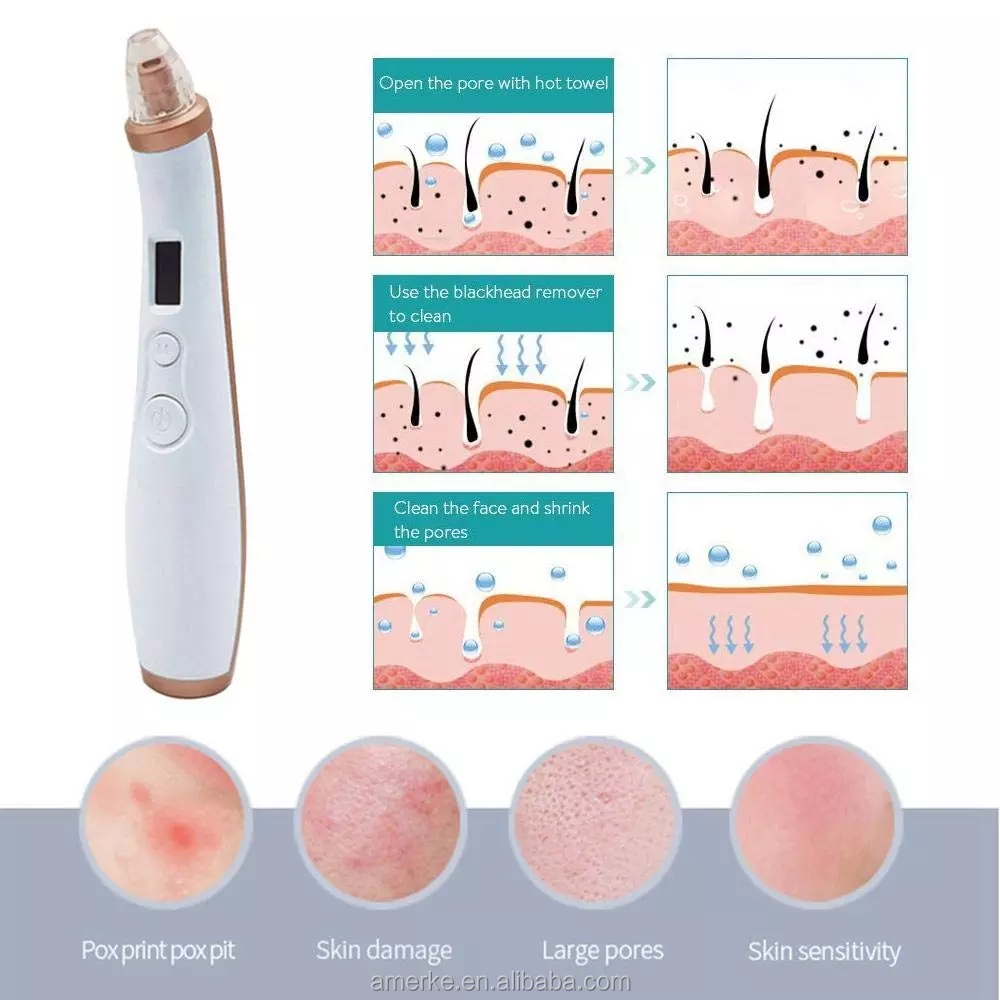 Facial pore electric tools kit gentle vacuum blackhead remover set