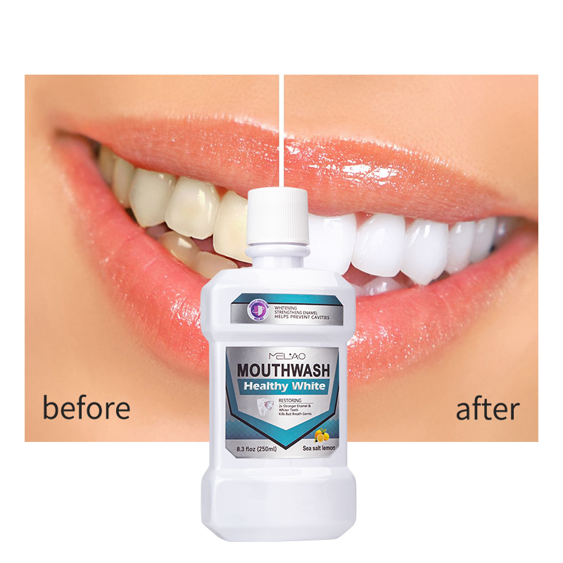 Wholesale Private Label Oragnic Teeth Whitening mouthwash Oral Hygiene Toothpaste Bleaching Remove Stains Dental