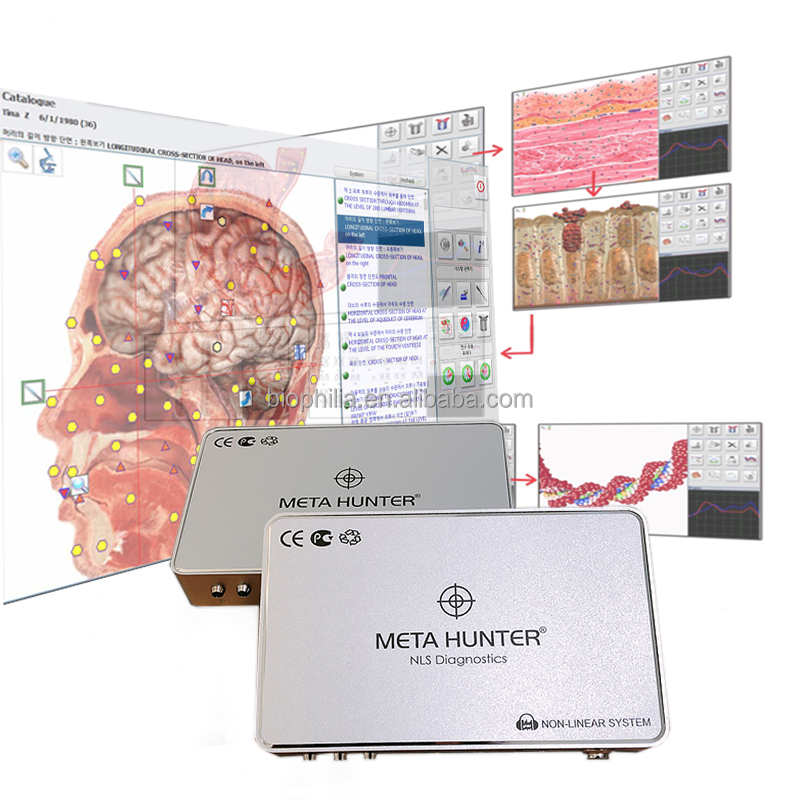 2022 Популярные сканеры для тела meta hunter metatron 4025 hunter с OEM
