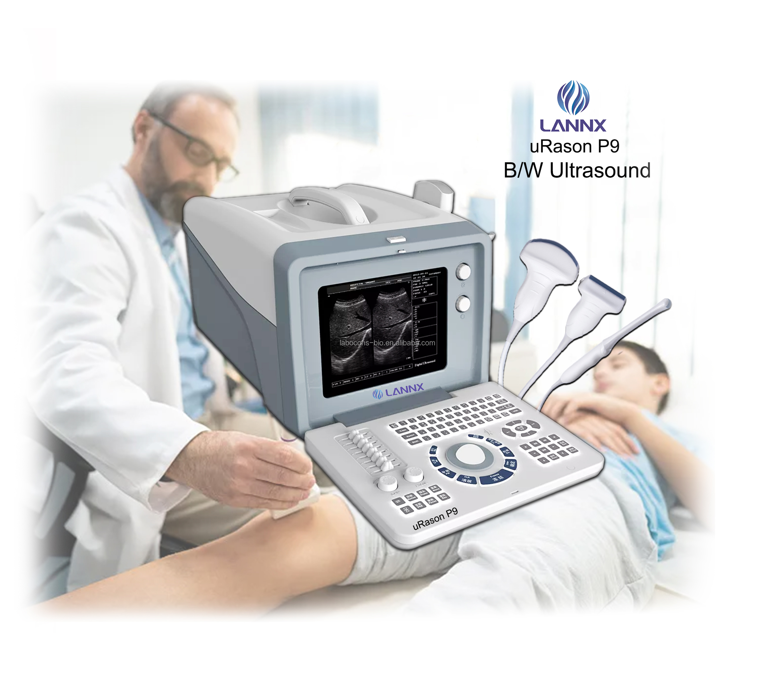 LANNX uRason P9 New Arrival Full Digital Ultrasonic Diagnostic Imaging System Laptop ultrasound scanner Ultrasonido