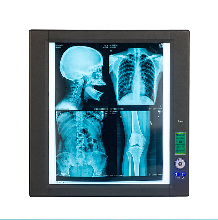Manufacturer price radiology equipment X-ray machine accessories medical x-ray film cassette