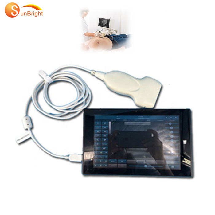 Новое поступление, беспроводной линейный USB-зонд/беспроводной выпуклый ультразвуковой зонд